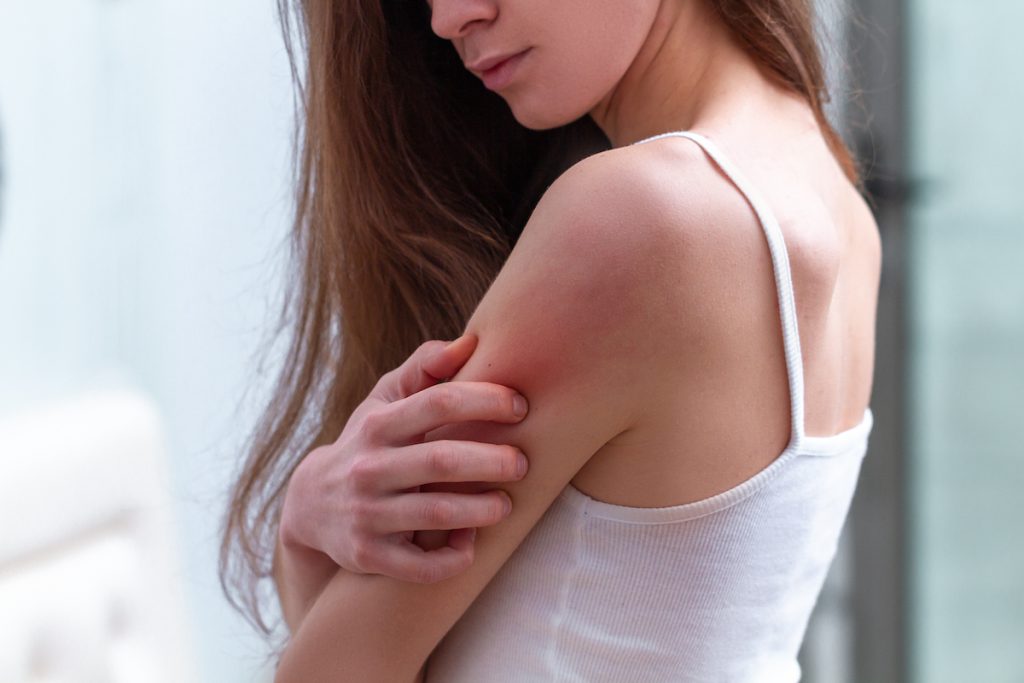 11 Methods to Deal with Psoriasis at Residence